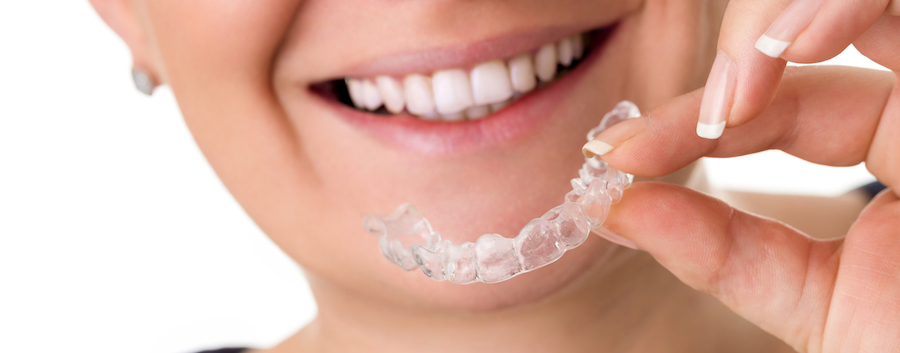 Woman with perfect teeth holding invisible braces, correction teeth braces for night