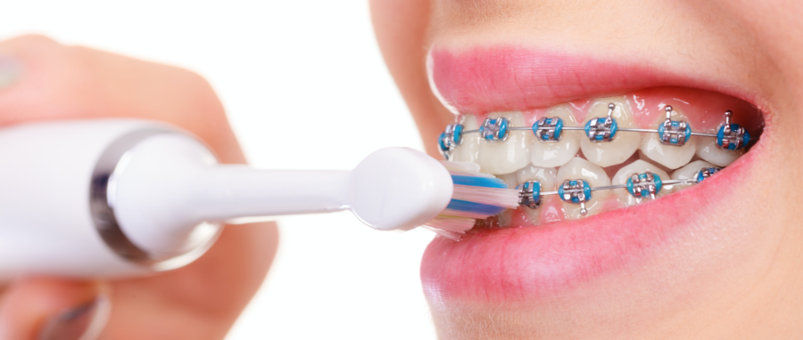 What's the best toothpaste for braces?