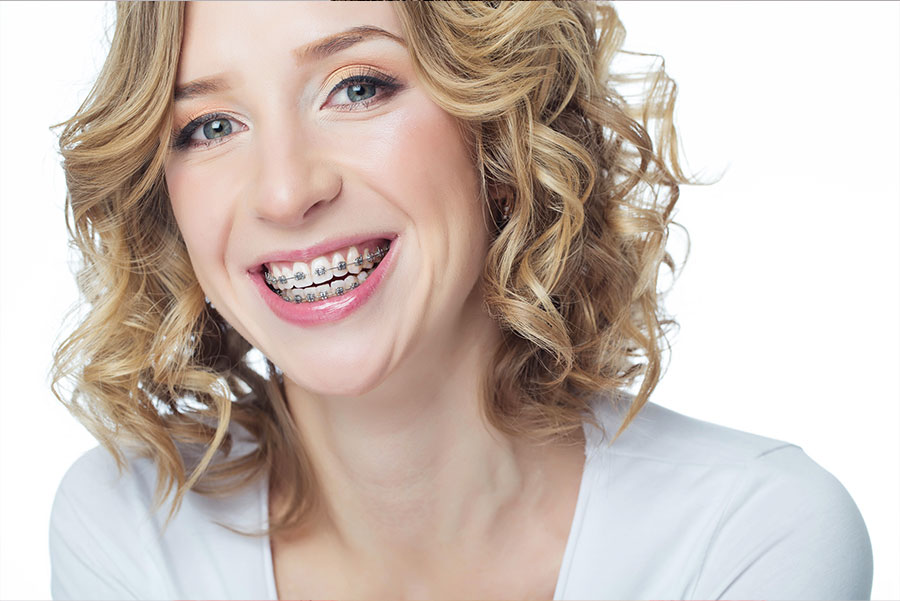 orthodontics for adults