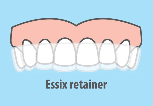 Essix retainer