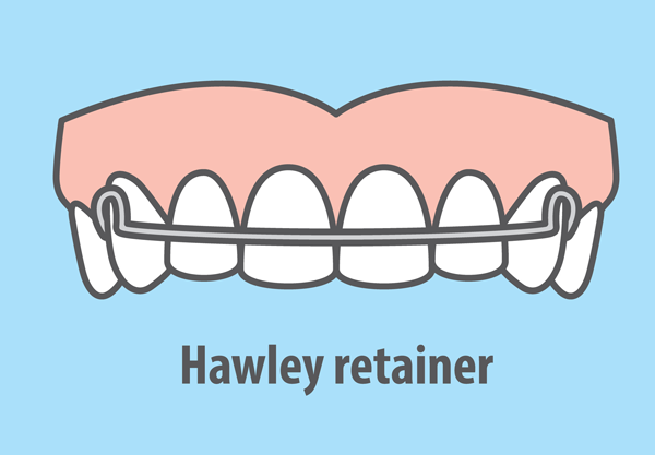 Hawley retainer
