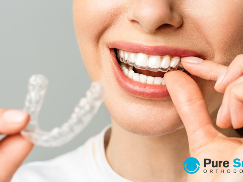 invisalign cost without insurance Austin Tx