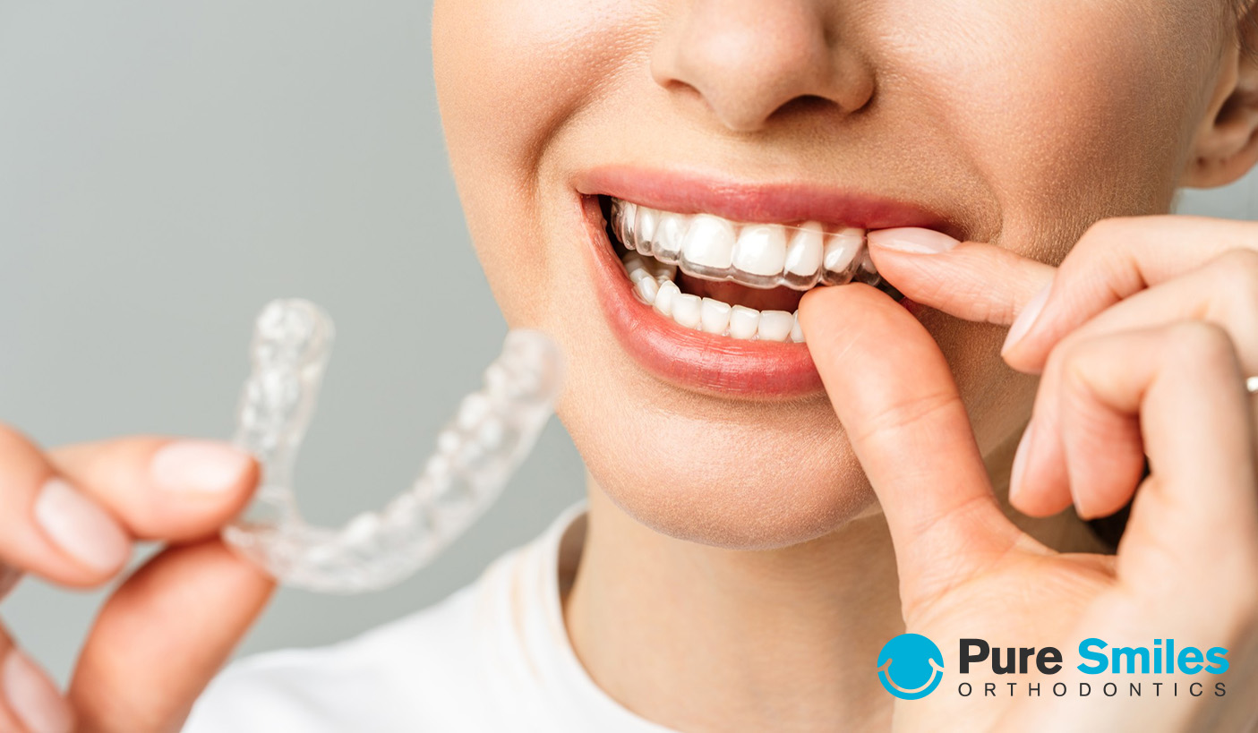 invisalign cost without insurance Austin Tx
