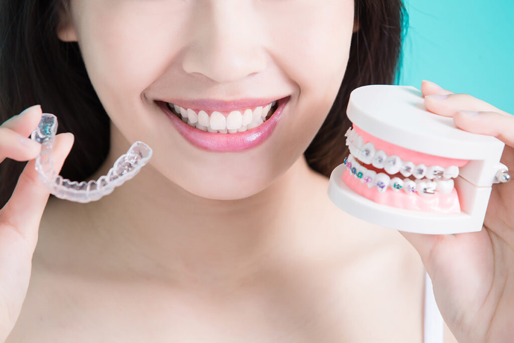 Invisalign or braces which one is faster