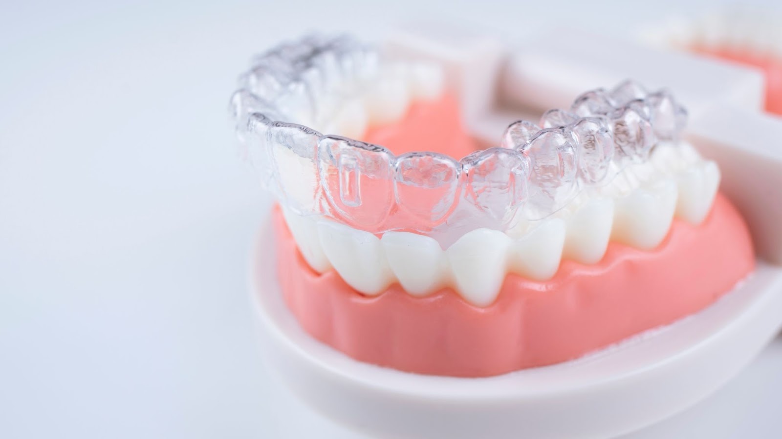 How Invisalign Technology Works