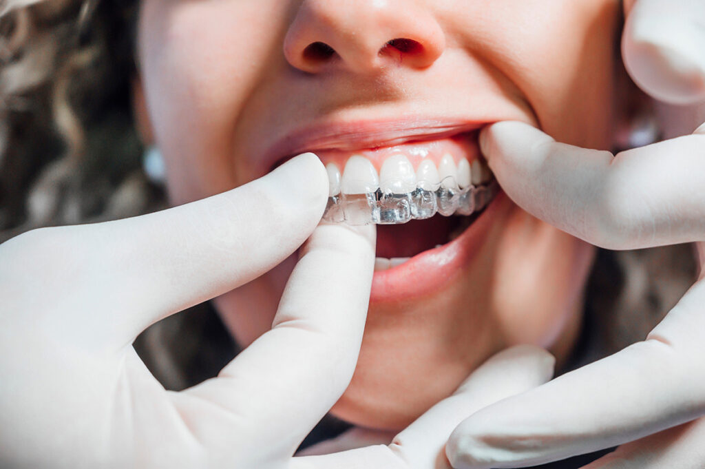 austin orthodontics