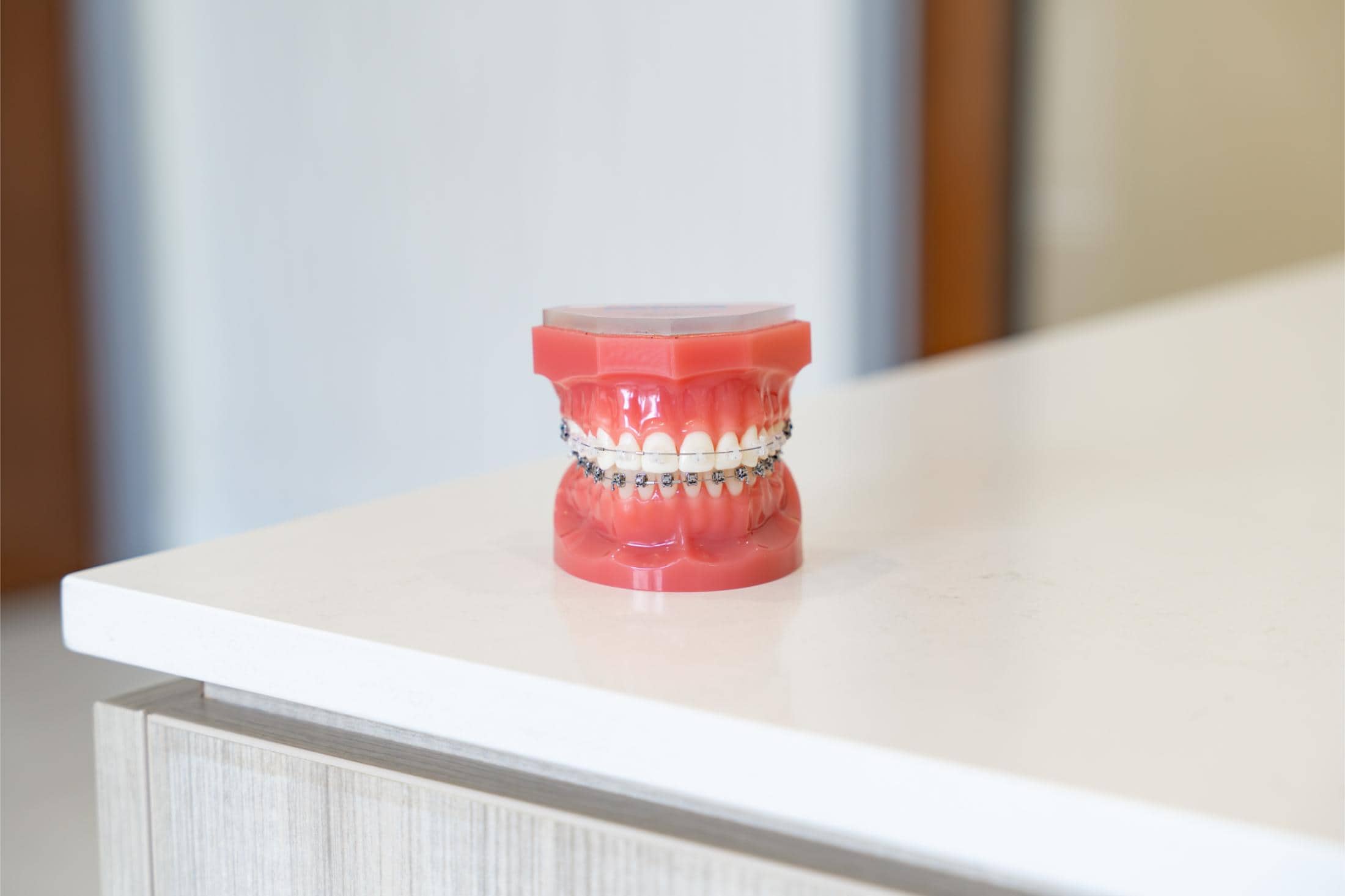 Clear Braces