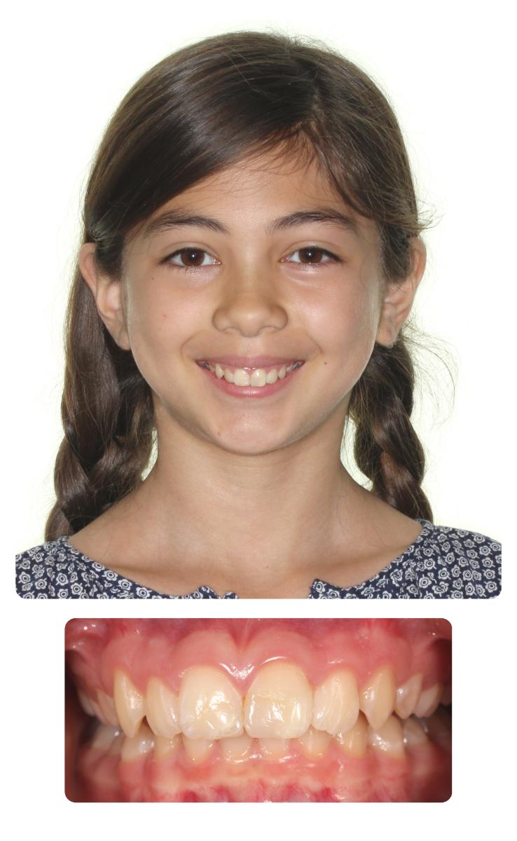 Ava Before