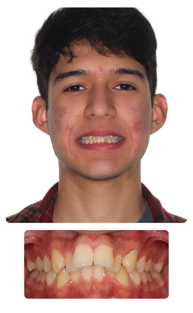 Emilio Before