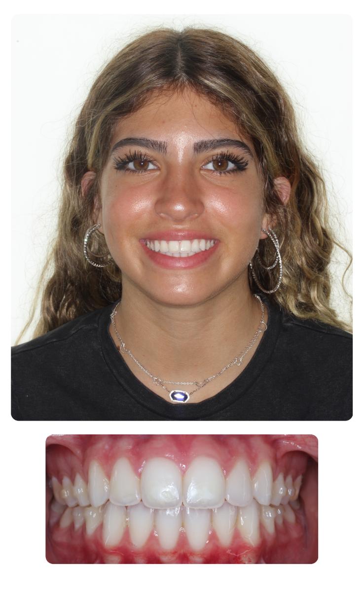 Gaby After