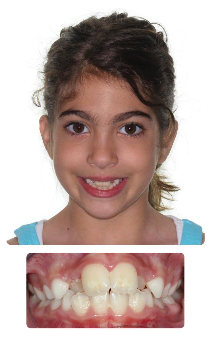 Gaby Before